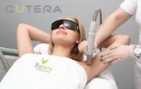 laser treatments dunkirk aesthetics